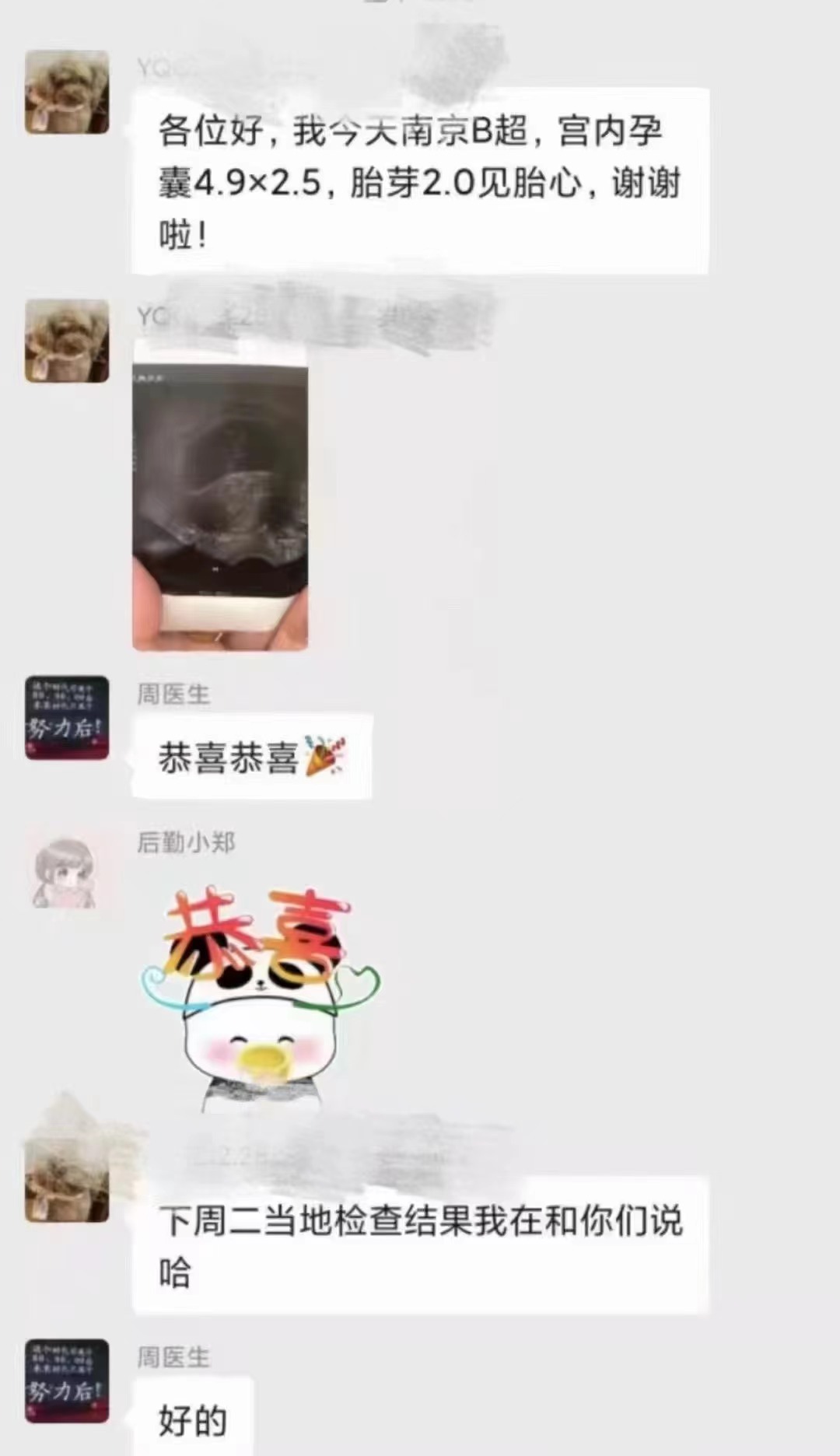 多囊卵巢综合征的魔掌也阻止不了的好孕气！