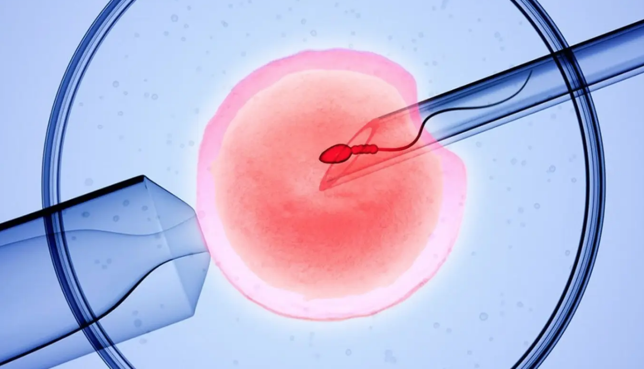 体外受精（IVF）的风险有哪些？
