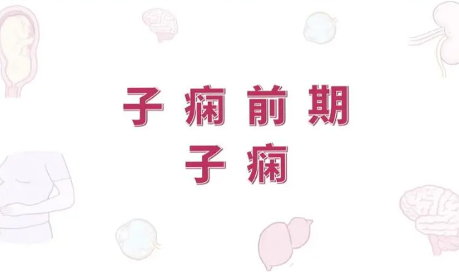 怀孕脚肿了？是不是子痫前期对照一下就知道！