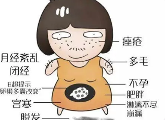 什么是多囊卵巢综合征？