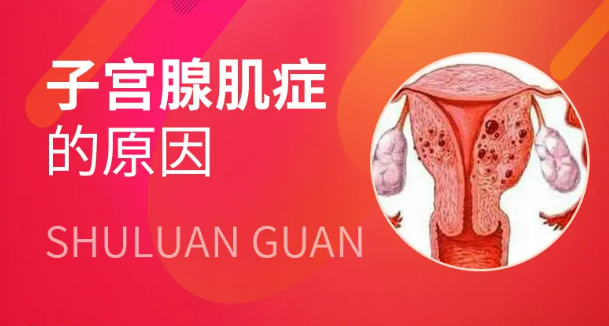 什么是子宫腺肌症？