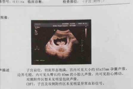 38岁，FSH＞10，在辅助生殖医院好孕啦！