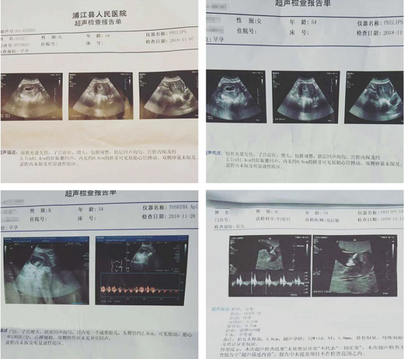 浙江省浦江最高龄产妇健康生子，幕后功臣原来是辅助生殖医院