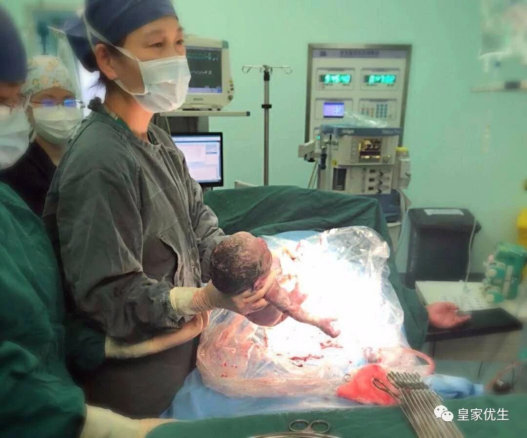 57岁失独妈妈艰辛求子路：这是一份用命换来的幸福，值得！