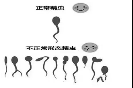 精子畸形率99%，还可以做试管婴儿吗？