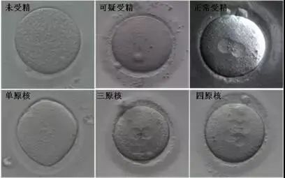 我的卵子为什么不能100%的正常受精？