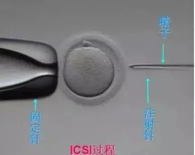 我的卵子为什么不能100%的正常受精？