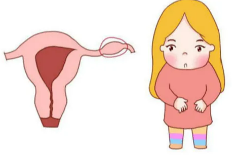异位妊娠有什么体征和症状？