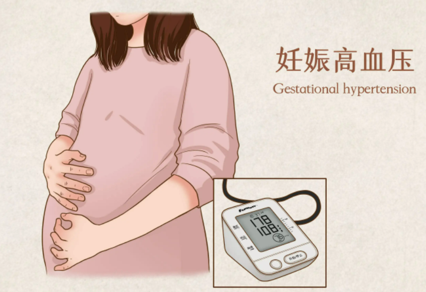 什么是妊娠期高血压？