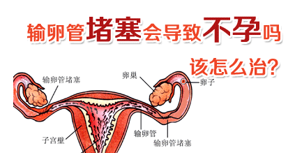 输卵管堵塞如何治疗？