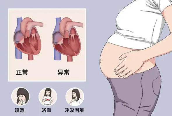 导致围产期心肌病的原因是什么？