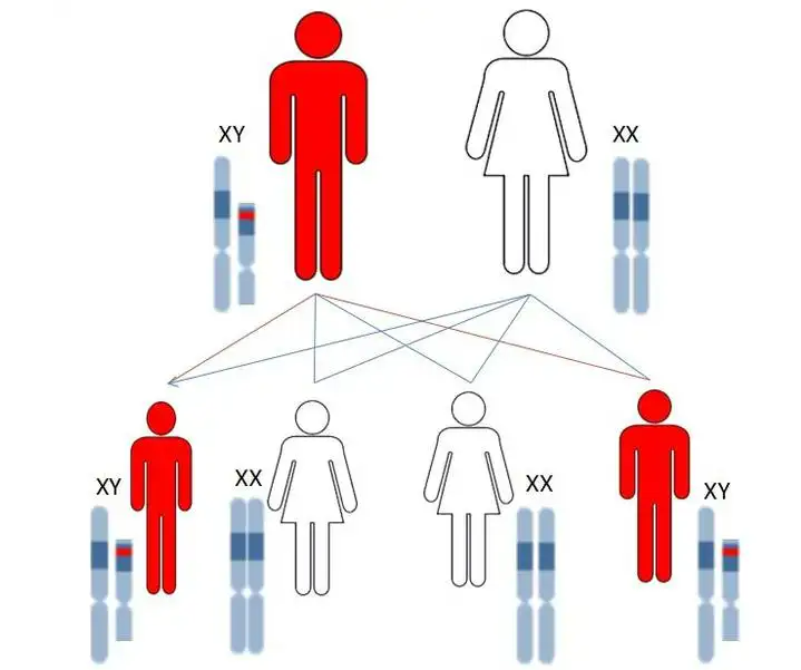 怀孕中孩子有先天性异常该怎么办？