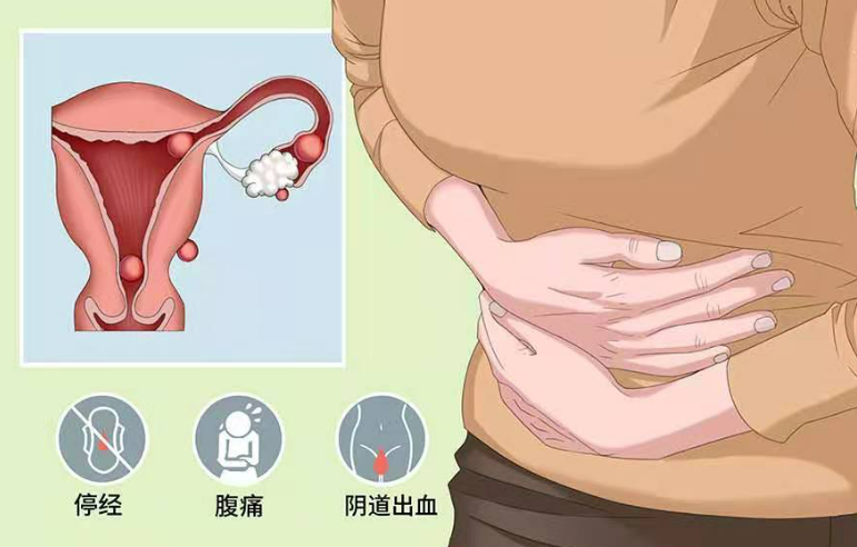 宫外孕后应该注意什么？