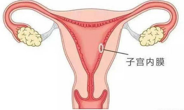 涉及子宫内膜并可能影响生育能力的情况有哪些？