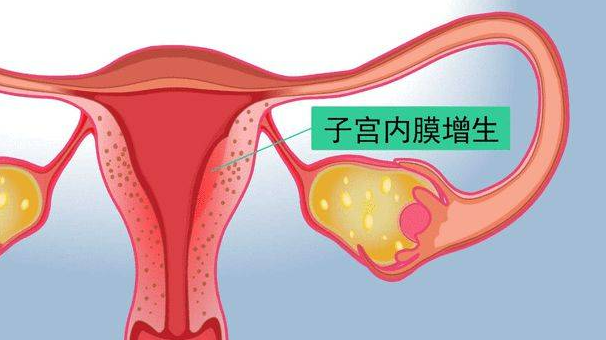 为什么黄体期缺陷会导致不孕？