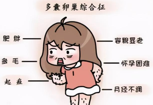 健康饮食、运动能否对多囊卵巢综合征起作用？