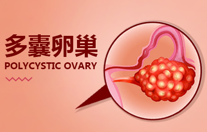 哪些药物对多囊卵巢综合征能起作用？（2）