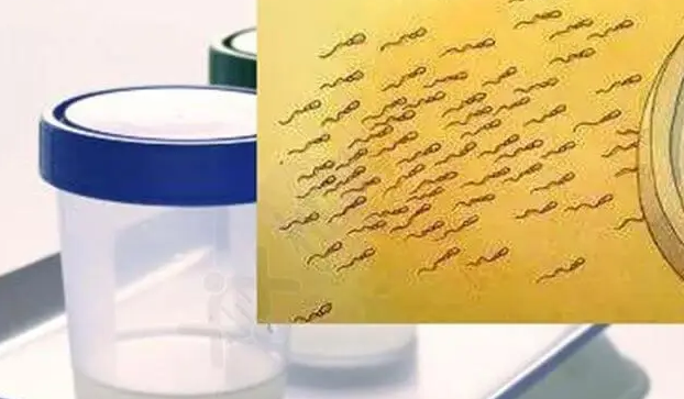 什么是Necrozoospermia与弱精子症？