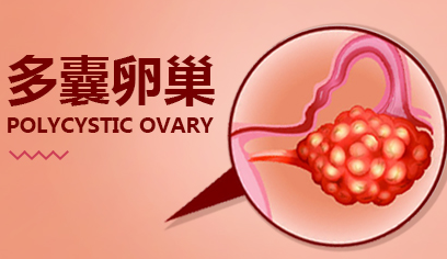 多囊卵巢综合征是什么？