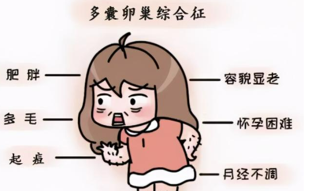 多囊卵巢综合征应该何时就诊？