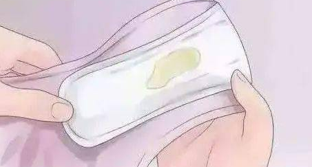 阴道分泌物异常应该何时就医？