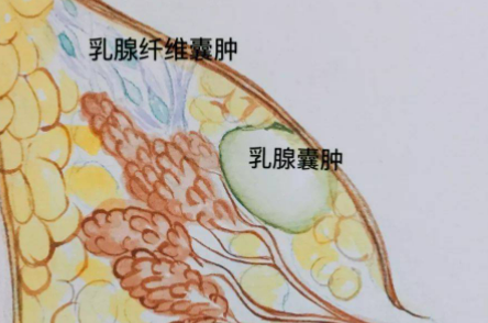 乳房疾病如何评估？