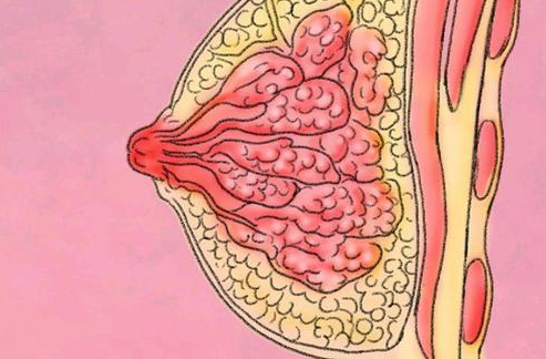 乳腺癌的类型有哪些？