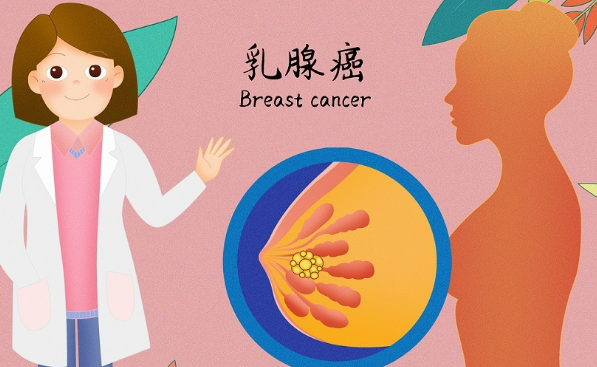 乳腺癌诊断后如何评估？