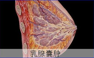 什么是乳房囊肿？