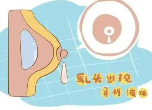 乳头溢液的病因是什么？
