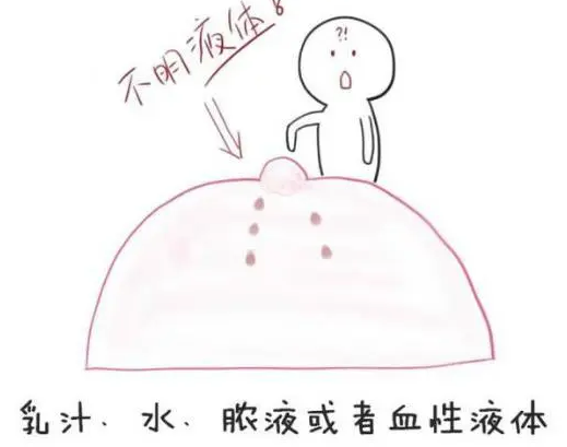 面对乳头溢液医生会怎么做？