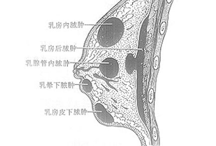 什么是乳房感染和乳房脓肿？