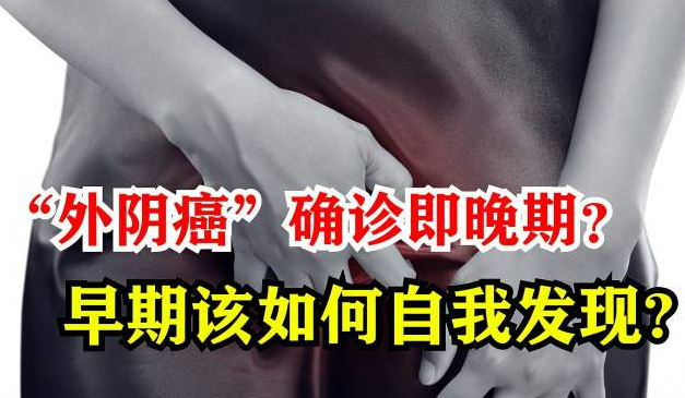 究竟什么是外阴癌？
