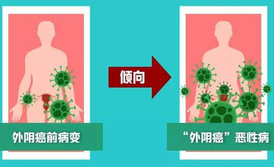外阴癌的风险因素有哪些？