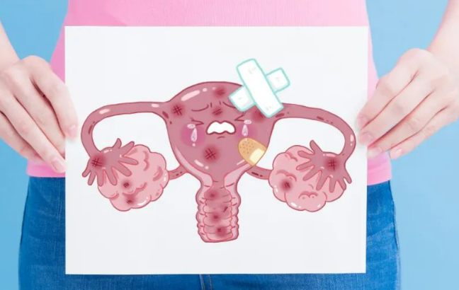 卵巢癌、输卵管癌和腹膜癌如何分期？