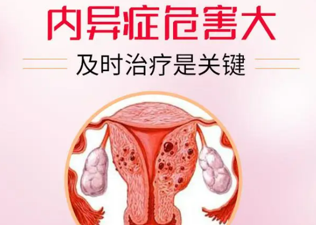 子宫内膜异位症如何诊断？