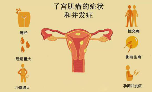 子宫肌瘤该如何诊断？