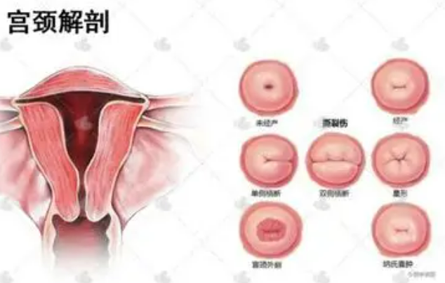 什么是宫颈黏液引起的不育问题？