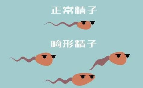 请问精子问题如何诊断？