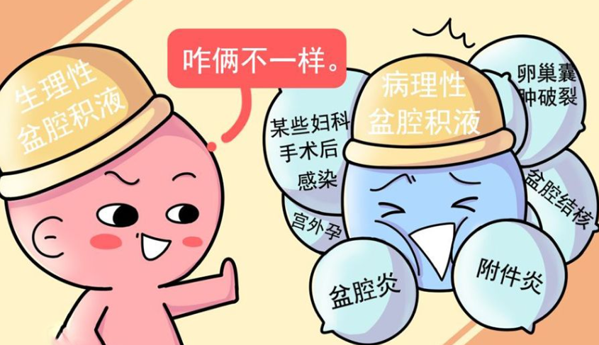 盆腔淤血综合征有什么症状？