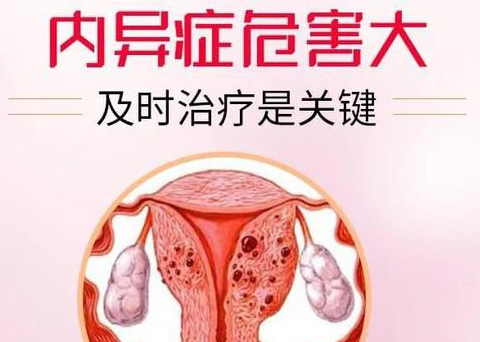 外阴子宫内膜瘤如何诊断和治疗？