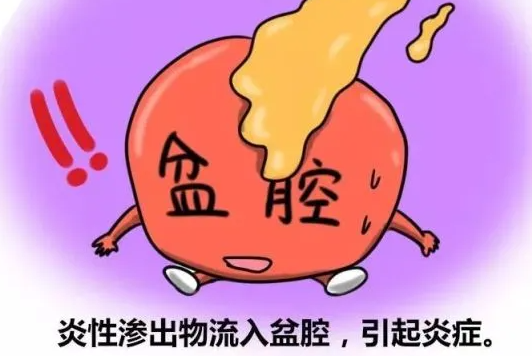 什么是女性生殖器-盆腔痛／插入障碍？
