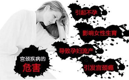 什么是子宫颈炎？