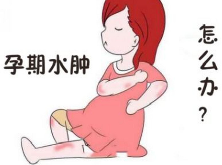 孕晚期水肿如何治疗？