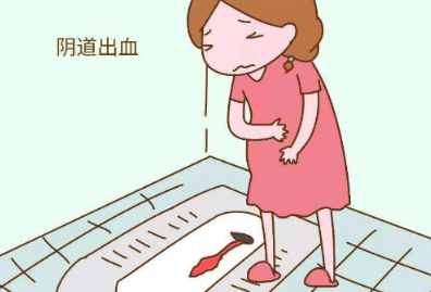 孕晚期阴道流血的风险因素有哪些？