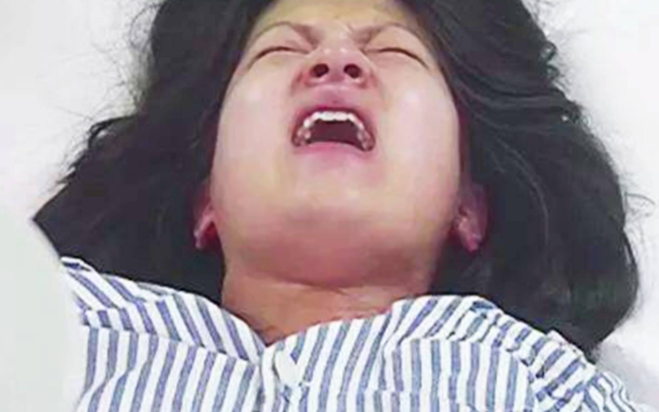 什么是异常胎位和胎先露？