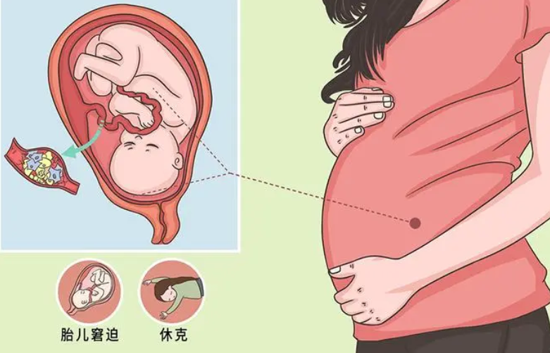 羊水栓塞要如何治疗？