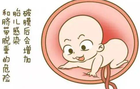 什么是脐带脱垂？
