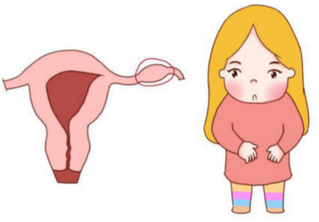 异位妊娠如何诊断？
