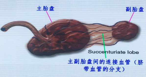 什么是血管前置？